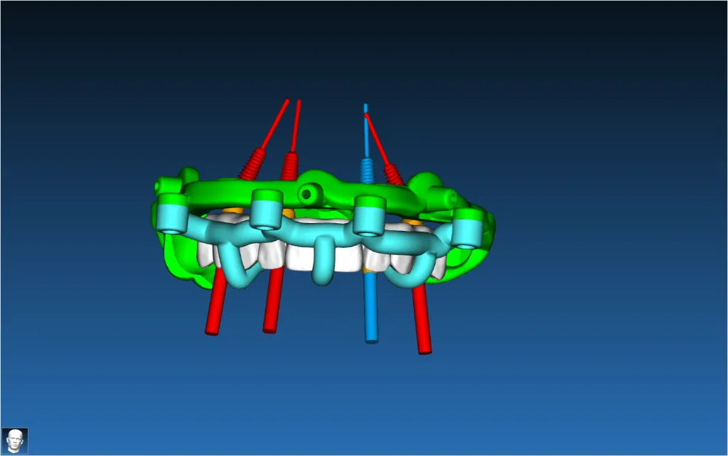 Stackable Guide Case 1