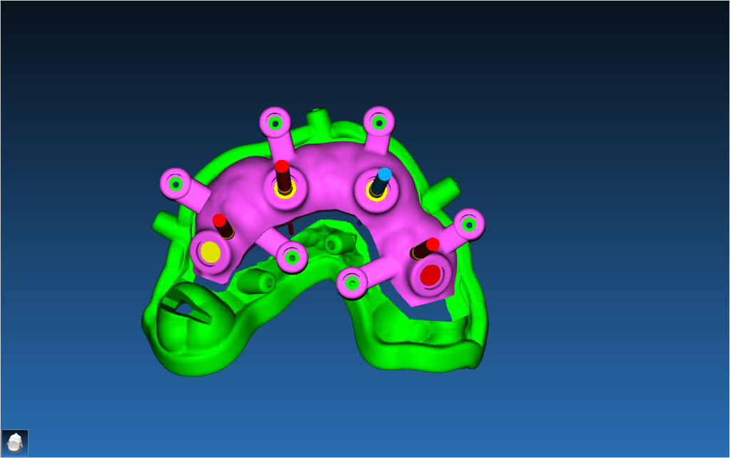 Stackable Guide Case 2
