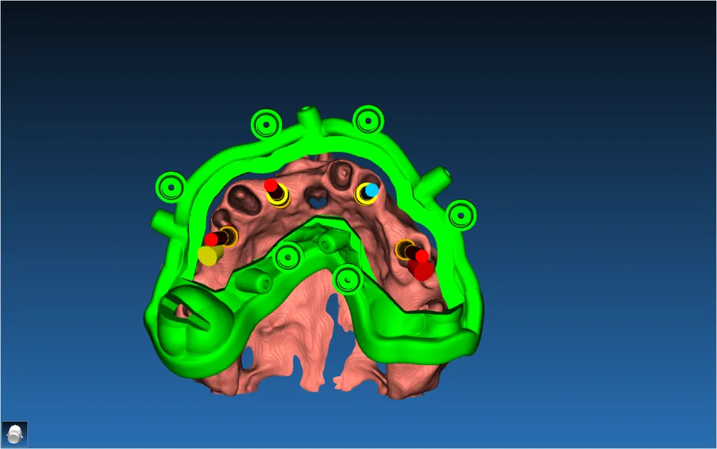 Stackable Guide Case 3