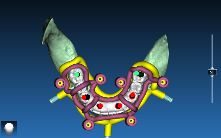 Stackable Guide Case 4