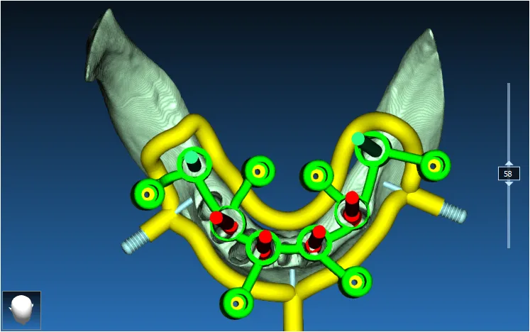 Stackable Guide Case 5