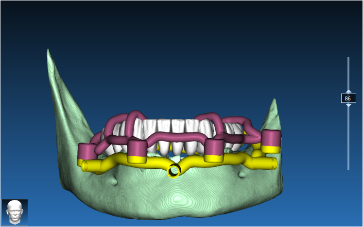 Stackable Guide Case 6